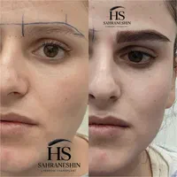 کاشت ابروی طبیعی|خدمات آرایشگری و زیبایی|تهران, قیطریه|دیوار