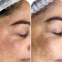 جذب نیروی خانم آنلاین باگوشی|استخدام بازاریابی و فروش|کازرون, |دیوار