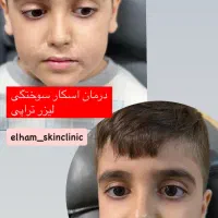 کلینیک لیزرموهای زائدالکساندرایت پلاس شاتی(هوشمند)|خدمات آرایشگری و زیبایی|رشت, گلسار|دیوار