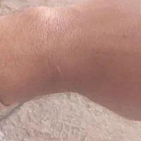 گیرمال (بیتالی)