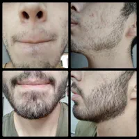 معجزه چسب ریش