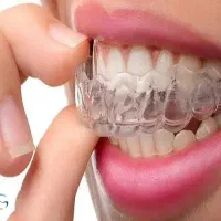 دندان مصنوعی و نایت گارد|آرایشی، بهداشتی، درمانی|اندیشه, اندیشه فاز ۳|دیوار