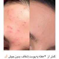 کرم شب آیسل پلاس|آرایشی، بهداشتی، درمانی|ایرانشهر, |دیوار