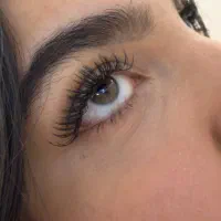 کاشت مژه