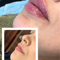 تخفیف ویژه افتتاحیه کلینیک زیبایی