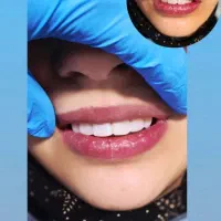 استخدام دندان پزشک پروانه دار متخصص در ارتودنسی