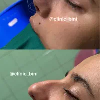 جراحی بینی اقساط بلند مدت|خدمات زیبایی و سلامت|تهران, گاندی|دیوار