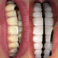 خدمات زیبایی و درمانی دندان،پوست،مو،بدن تا۵۰درصد