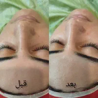 پاکسازی پوست