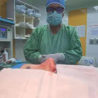 جشنواره جراحی زیبایی بینی توسط دکتر سیدقیاسی