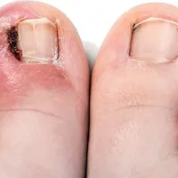 آموزش و خدمات پودولوژی|خدمات آموزشی|شیراز, قصرالدشت|دیوار