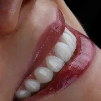 دندانپزشکی مجهز به بی حسی بدون درد دیجیتالی+اقساط|خدمات آرایشگری و زیبایی|خرم‌آباد, |دیوار