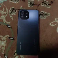 گوشی می 11لایت