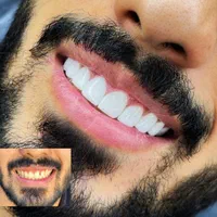 دندانپزشکی با کیفیت بصورت اقساطی|خدمات آرایشگری و زیبایی|شیراز, قدوسی غربی|دیوار