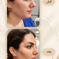 بهترین دکتر تزریق چربی تهران|خدمات زیبایی و سلامت|تهران, سعادتآباد|دیوار