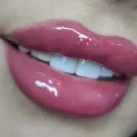 زیبایی ، ژل و بوتاکس و آموزش