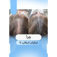 مدل رایگان پوست و مو با شرایط ویژه