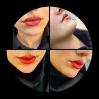 ژل و بوتاکس|خدمات آرایشگری و زیبایی|اهواز, سلطانمنش|دیوار