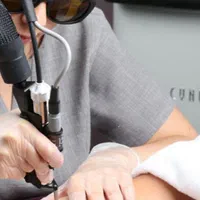 لیزر موهای زائد