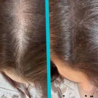 کلینیک پوست و مو با تخفیفات فوق العاده|خدمات آرایشگری و زیبایی|فردیس, منظریه|دیوار