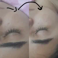 فیشیال و پاکسازی تخصصی خانم ها و آقایون