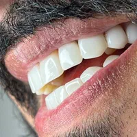 جشنواره تخفیفی دندانپزشکی درمانی و زیبایی|خدمات آرایشگری و زیبایی|تهران, سلسبیل جنوبی|دیوار