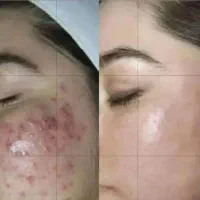 آف چند روزه قیمت 500