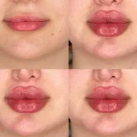 زیبایی|خدمات آرایشگری و زیبایی|دزفول, |دیوار