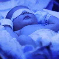 اجازه دستگاه زردی نوزاد تضمینی