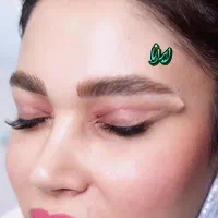 بلفاروبلاستی( جراحی پلک بدون رد بخیه)|خدمات آرایشگری و زیبایی|یاسوج, |دیوار