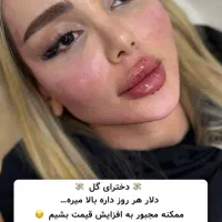 بوتاکس فقط با ۲۰۰ هزارتومان