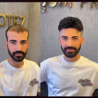 پروتز مو  سنندج|خدمات آرایشگری و زیبایی|سنندج, |دیوار