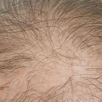 هیرفیلر مو دکتر CYJ|خدمات آرایشگری و زیبایی|تهران, تهرانسر غربی|دیوار