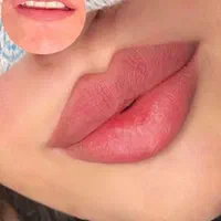 جشنواره تزریق ژل بوتاکس فیلر پی آر پی|خدمات آرایشگری و زیبایی|تبریز, |دیوار