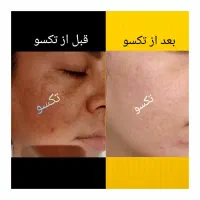 محصولات زیبایی ودرمانی تکسو