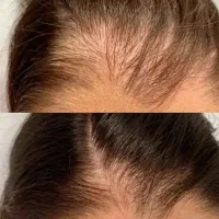 زیبایی دائمی یک بار برای همیشه