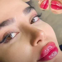 کلینیک تزریق ژل روسی ۳۴۹بوتاکس پروفایلومتدmd/لیزر|خدمات زیبایی و سلامت|تهران, طرشت|دیوار