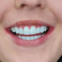 کامپوزیت زیبایی|خدمات آرایشگری و زیبایی|اسلامشهر, شهرک قائمیه|دیوار