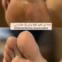 جهت تکمیل آلبوم|خدمات آرایشگری و زیبایی|رشت, گلباغ نماز|دیوار