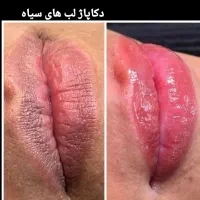 تخفیف یلدایی ۸۸۰ شیدینگ لب تضمین بدون درد|خدمات آرایشگری و زیبایی|دورود, |دیوار