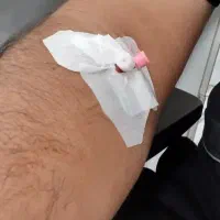 سرم تراپی تزریقات بخیه درمان زخم...۲۴ساعته درمنزل