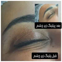 آموزش کار با دستگاه های زیبایی و فشیال