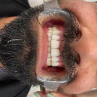 جشنواره تابستانه کامپوزیت فقط ۹۹۰ تومان|خدمات آرایشگری و زیبایی|شیراز, تندگویان|دیوار