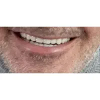 دندانسازی|آرایشی، بهداشتی، درمانی|جغتای, |دیوار