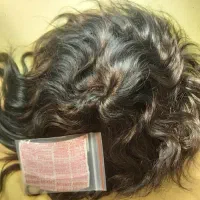 خدمات پروتز در محل شما