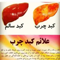 کبد چرب