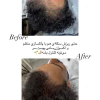 درمان مشکلات مو و پوست سر(اسکراب اسکالپ)|خدمات آرایشگری و زیبایی|شیراز, تاچارا|دیوار