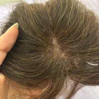 پروتز مو طبیعی ، پروتز جلوی سر ، نصب با سه گیره|آرایشی، بهداشتی، درمانی|ری, دیلمان|دیوار