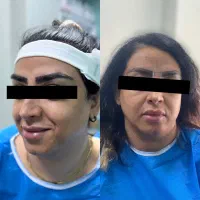 فرصت ویژه و محدود کاشت ابرو|خدمات آرایشگری و زیبایی|رشت, گلسار|دیوار