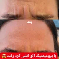 چین و چروک گاتیو|آرایشی، بهداشتی، درمانی|قم, آذر (نکویی)|دیوار